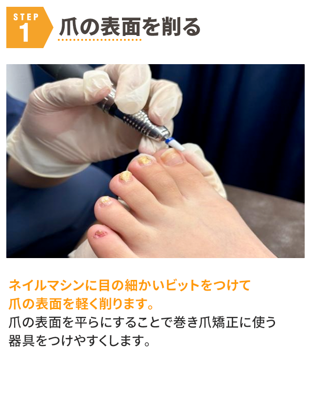 STEP1