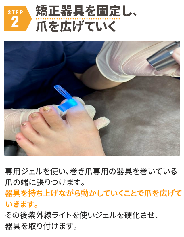 STEP2